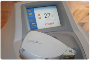 Epilation par le système laser diode LightSheer